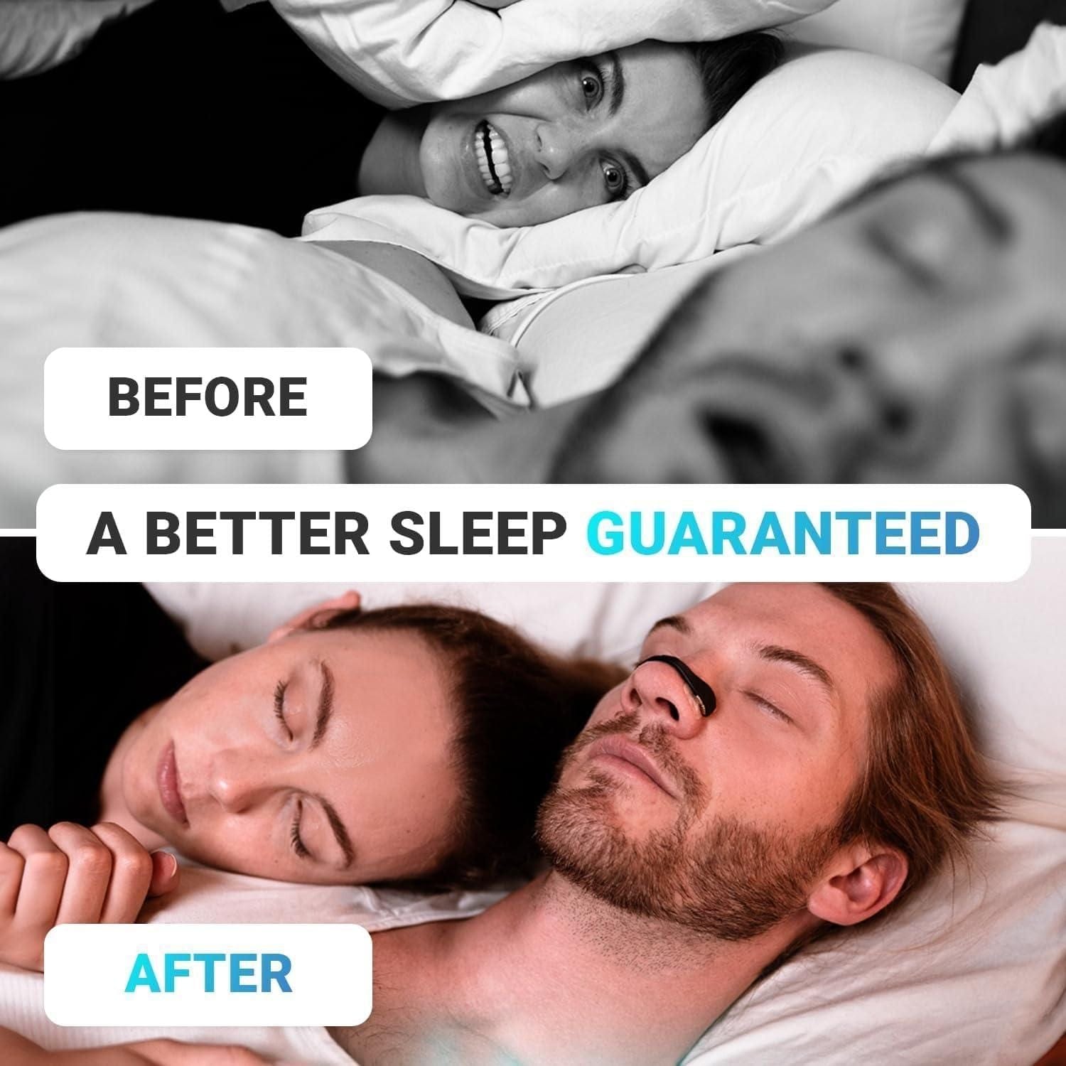 Anti-snoring Nasal Strips | Strip For Nose Snoring Device Anti-snoring Nasal StripsBreathing Nasal Strip Kit
