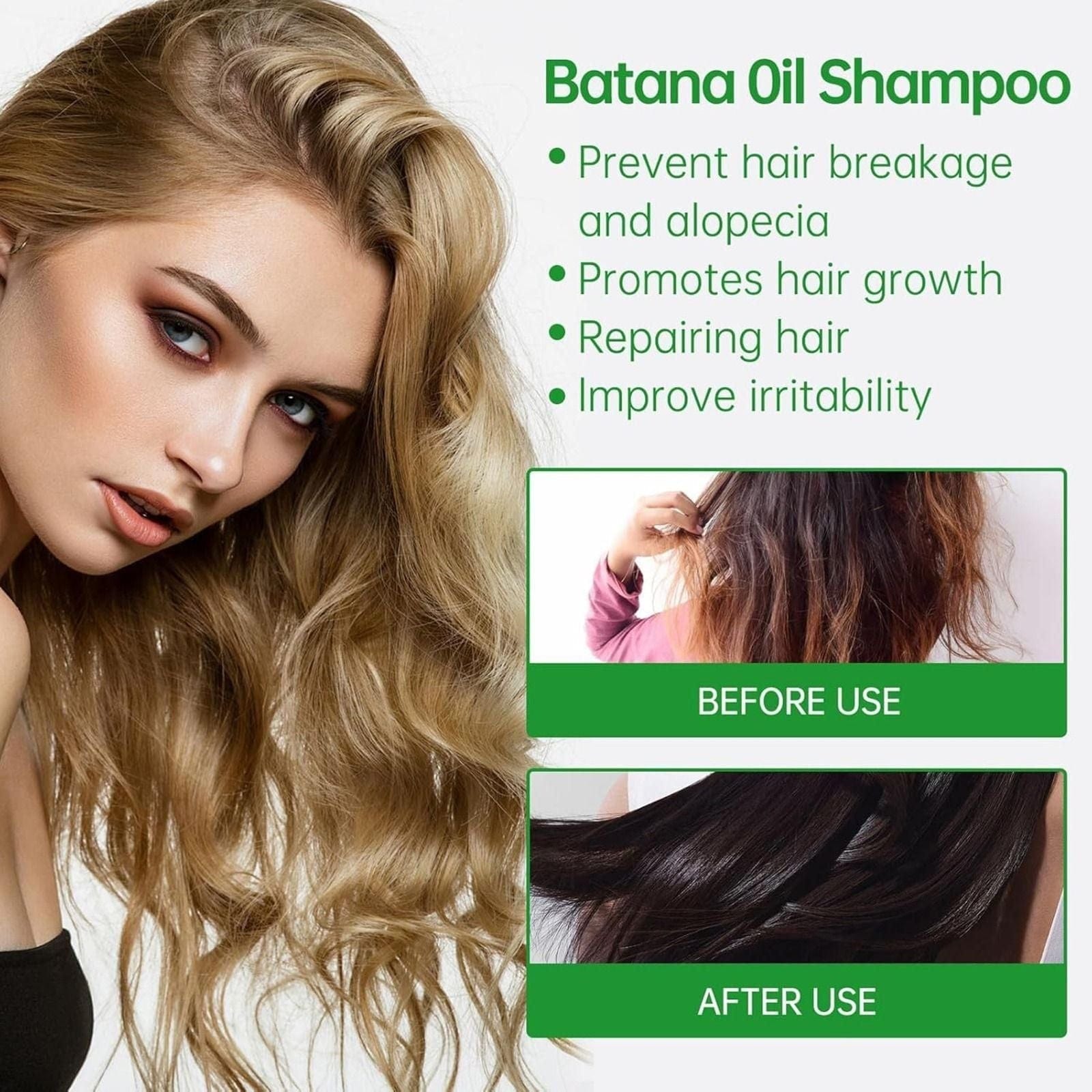 Batana Oil Shampoo for Hair Growth (Pack of 2) | Oil Rosemary Batana Oil Shampoo Hair Growth Conditioner Hair Care Batana Oil Shampoo for Hair Growth (Pack of 2) Zaavio.co®