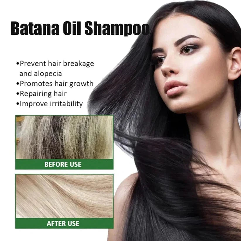 Batana Oil Shampoo for Hair Growth (Pack of 2) | Oil Rosemary Batana Oil Shampoo Hair Growth Conditioner Hair Care Batana Oil Shampoo for Hair Growth (Pack of 2) Zaavio.co®