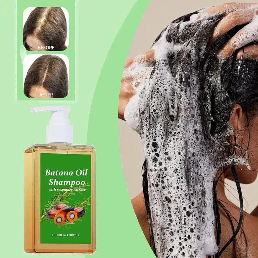 Batana Oil Shampoo for Hair Growth (Set of 2) | Oil Rosemary Conditioner Hair Care Batana Oil Shampoo for Hair Growth (Set of 2)