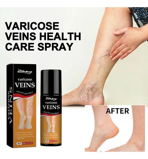 BEE VARICOSE VEINS RELIEF SPRAY (SET OF 2) Bee Venom Varicose Veins Relief Spray (Set Of 2)