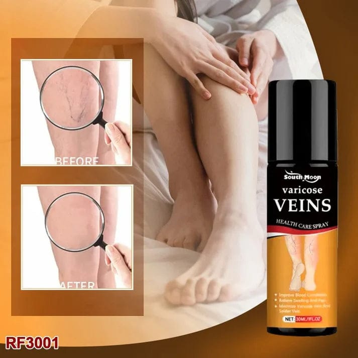 BEE VARICOSE VEINS RELIEF SPRAY (SET OF 2) Bee Venom Varicose Veins Relief Spray (Set Of 2)