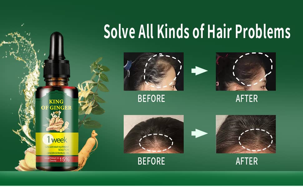 Best Hair Growth Oil Hair Fall Treatment Regrowth Serum Pack of 2 Hair Growth Oil - Buy 1, Get 1 Free