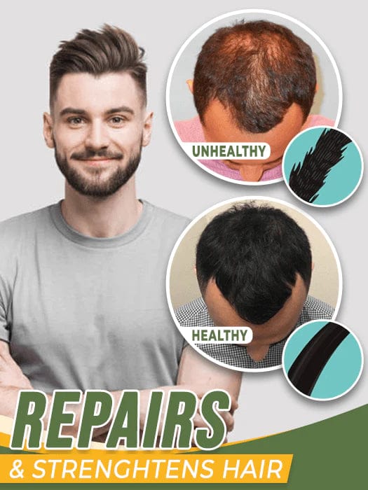 Best Hair Growth Oil Hair Fall Treatment Regrowth Serum Pack of 2 Hair Growth Oil - Buy 1, Get 1 Free