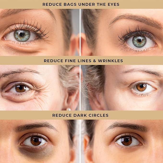 Cafyn™️ | Eye Cream Under Eye Cream For Dark Circles Mosturizer Cream For Eye Cafyn™️ Instant Firm Eye Bag Cream (Pack of 2) Zaavio®