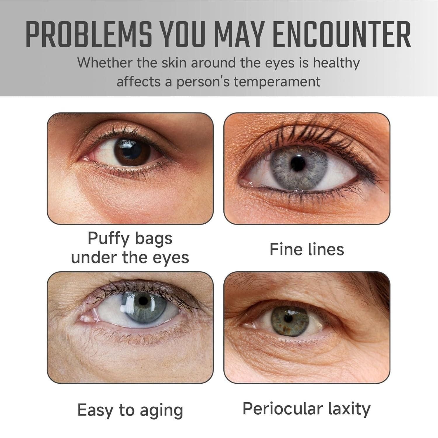 Eye Essence Oil (Set of 2) | Eye Vitamins Supplements For Eyesight Diertery Eyes Vitamin Food Eye Essence Oil (Set of 2)
