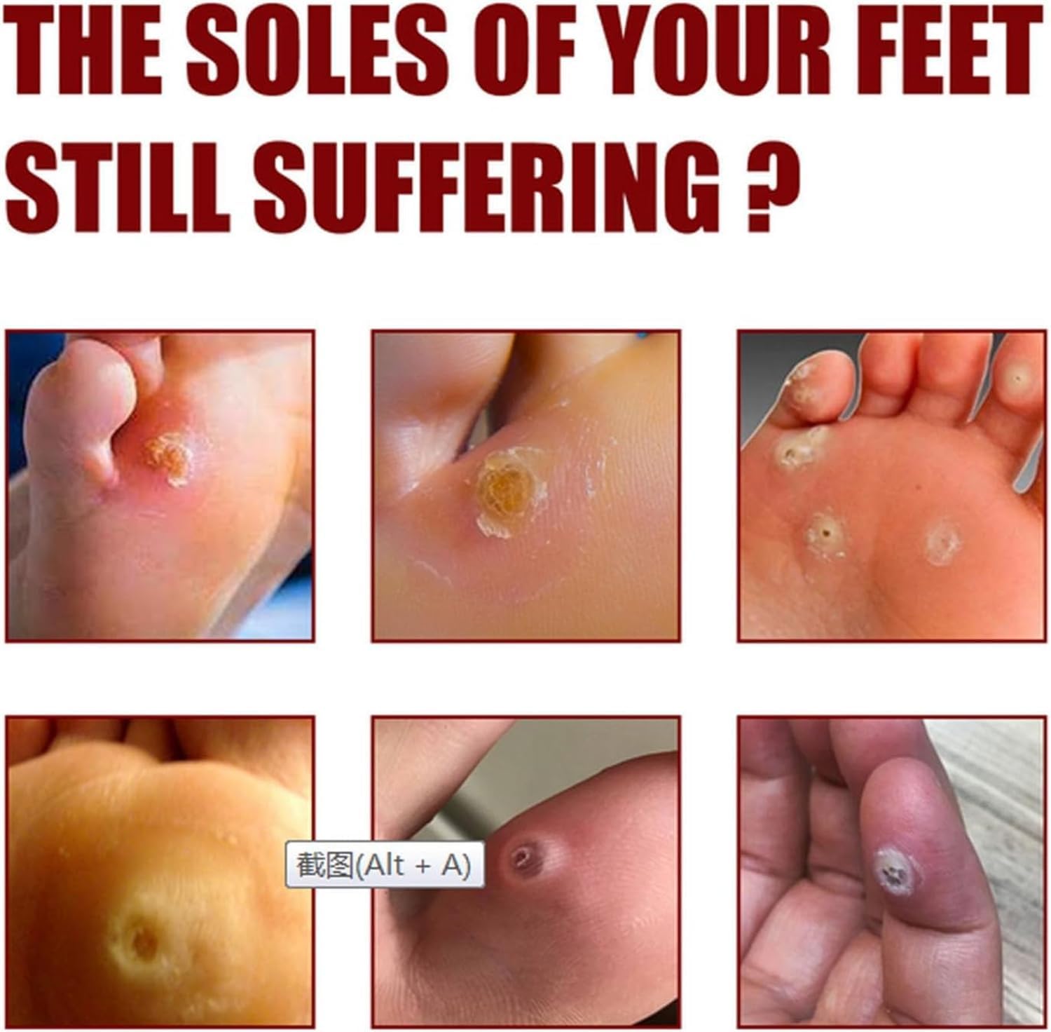 Feet Corn Removal Serum (Set of 2) Feet Corn Removal Serum (Set of 2)