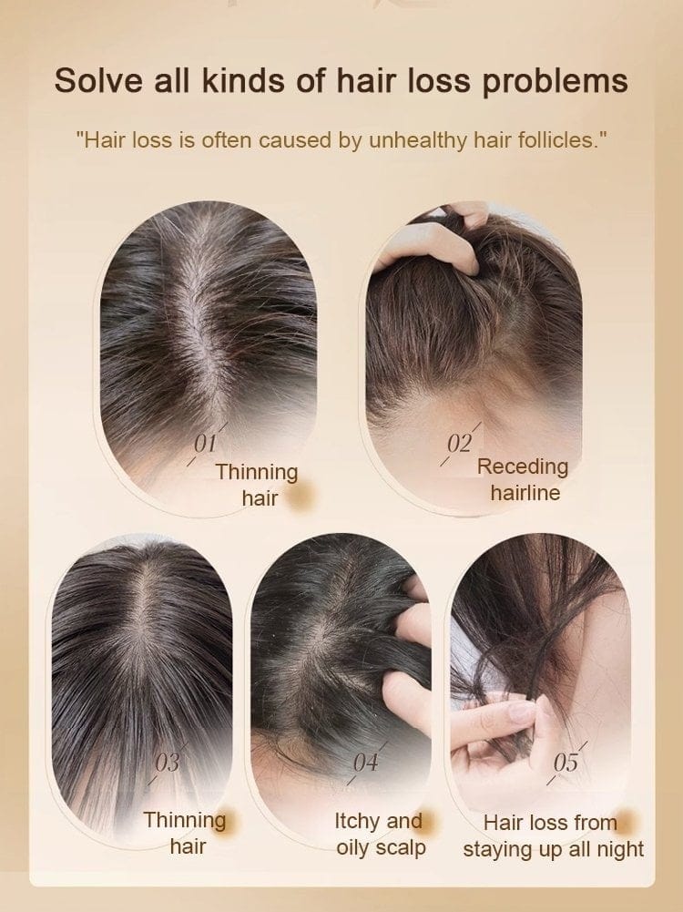 Ginger Anti-hair Loss Shampoo | Anti Hair Fall Shampoo Hair Growth Ginger Hairex Reduce Hair Loss Ginger Anti-Hair Loss Shampoo (Set of 3)