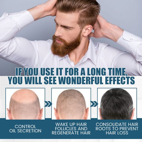Hair Growth Serum Premature Greying Oil Serum Hair Oil - Anti-greying Hair Serum Anti-greying Hair Serum