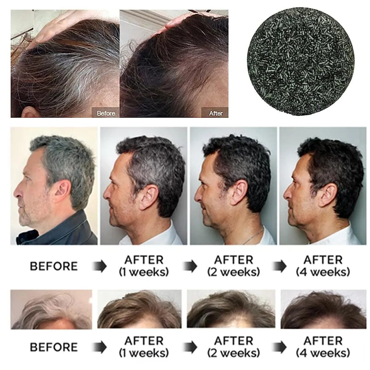 Hair Growth Serum Premature Greying Oil Serum Hair Oil - Anti-greying Hair Serum Anti-greying Hair Serum