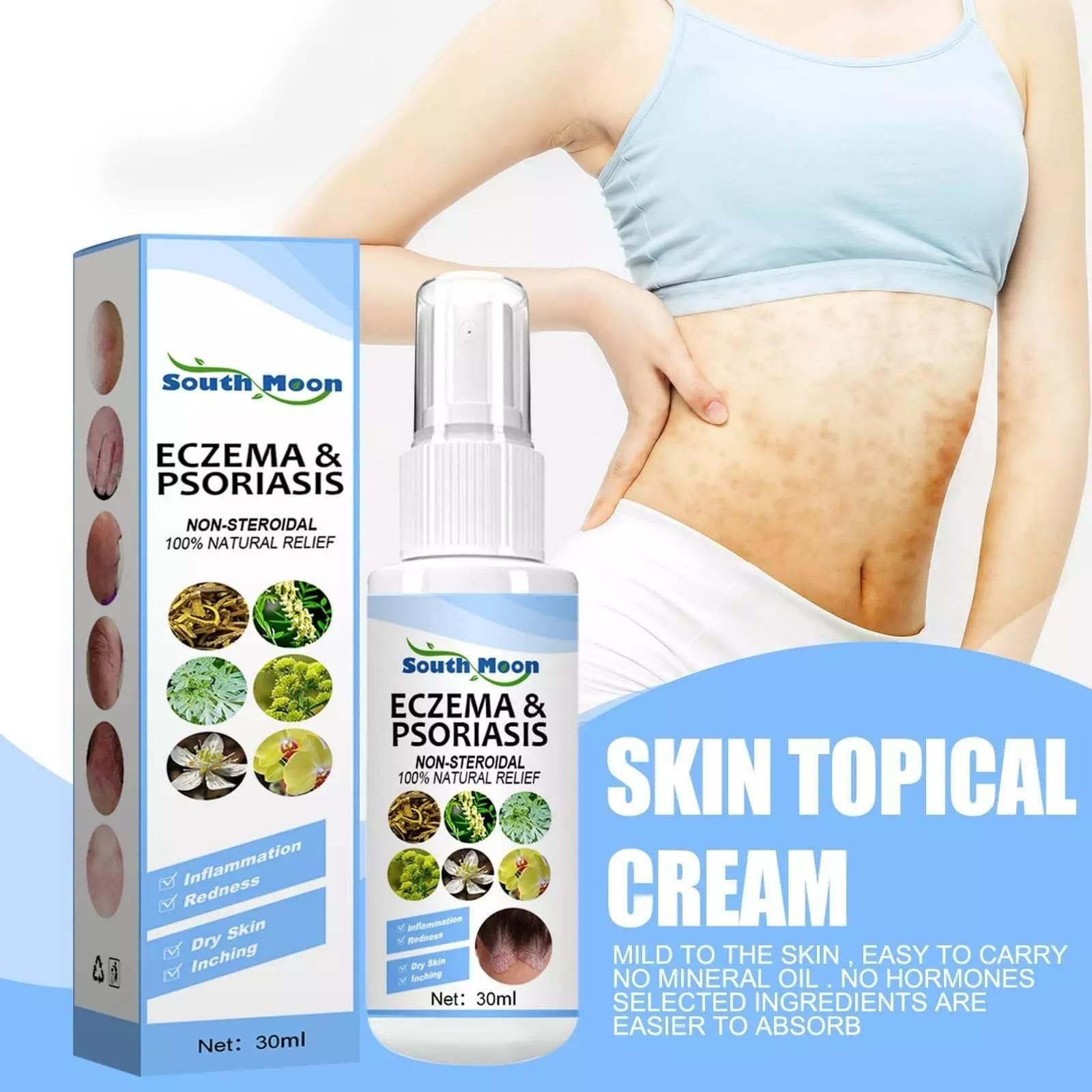 Herbal Psoriasis Relief Spray Herbal Psoriasis Relief Spray