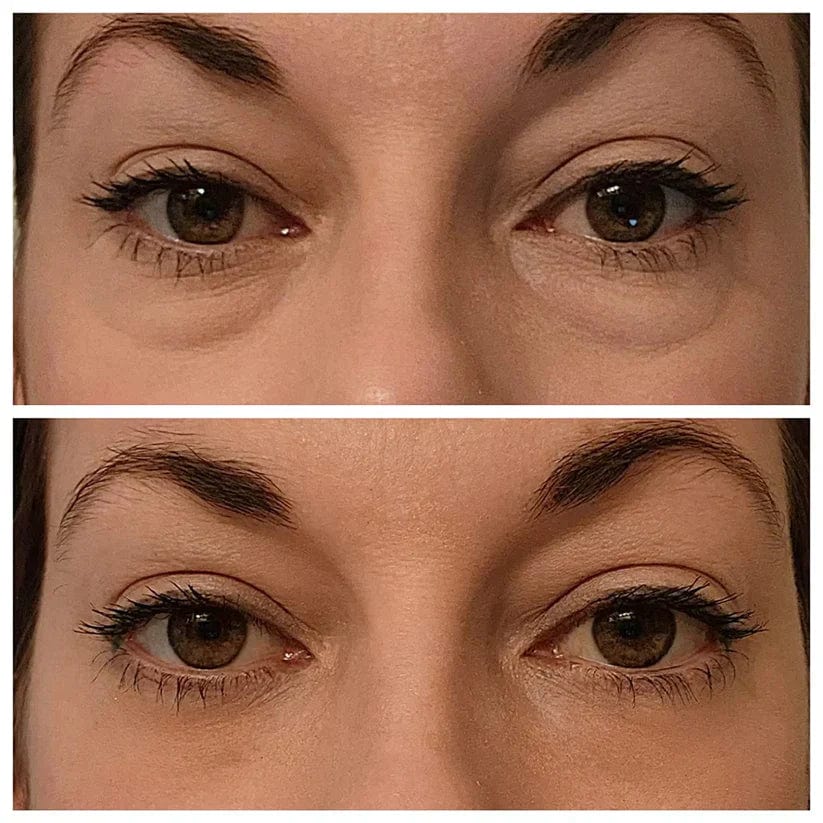 Instant Firm Eye Bag Cream ORIGINAL™ Instant Firmx Eye Bag Cream Zaavio®