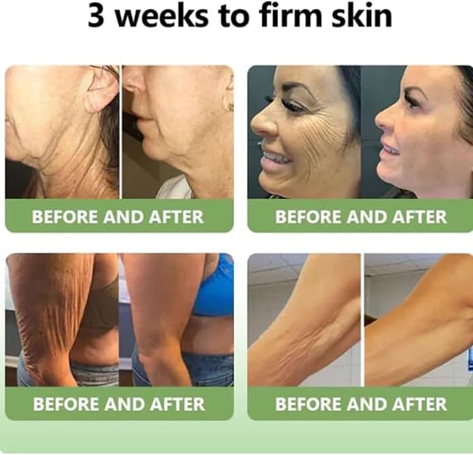 Luxelift™ (Pack of 2) | Skin Firming Collagen Cream Moisturiser Body Lotion Pack of 2 Luxelift™ Collagen Firming Body Cream (Pack of 2) Zaavio®