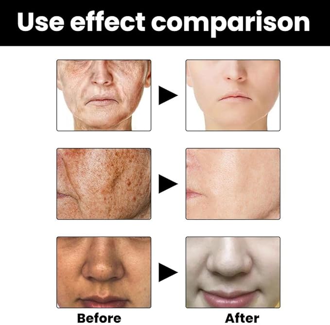 Melanin Corrector Serum (Set of 2) | Vitamin c serum Face Masks Skin Care Products Facial Oil Melanin Corrector Serum (Set of 2)