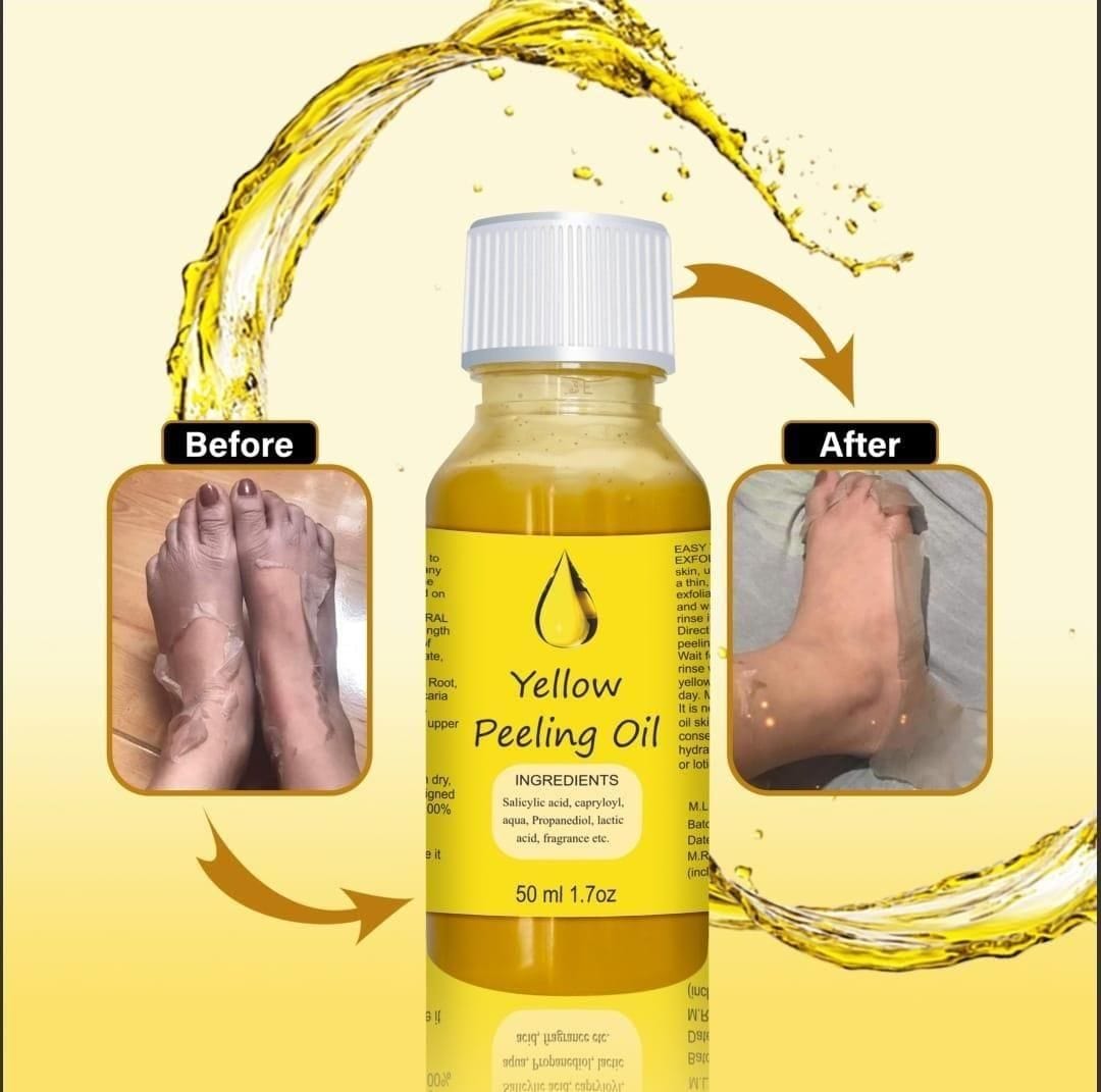 Peeling Oil for Skin (Set of 2) | Skin-Care Body Oil Face Oil Body care Yellow Peeling Oil Peeling Oil For Skin (Set of 2)