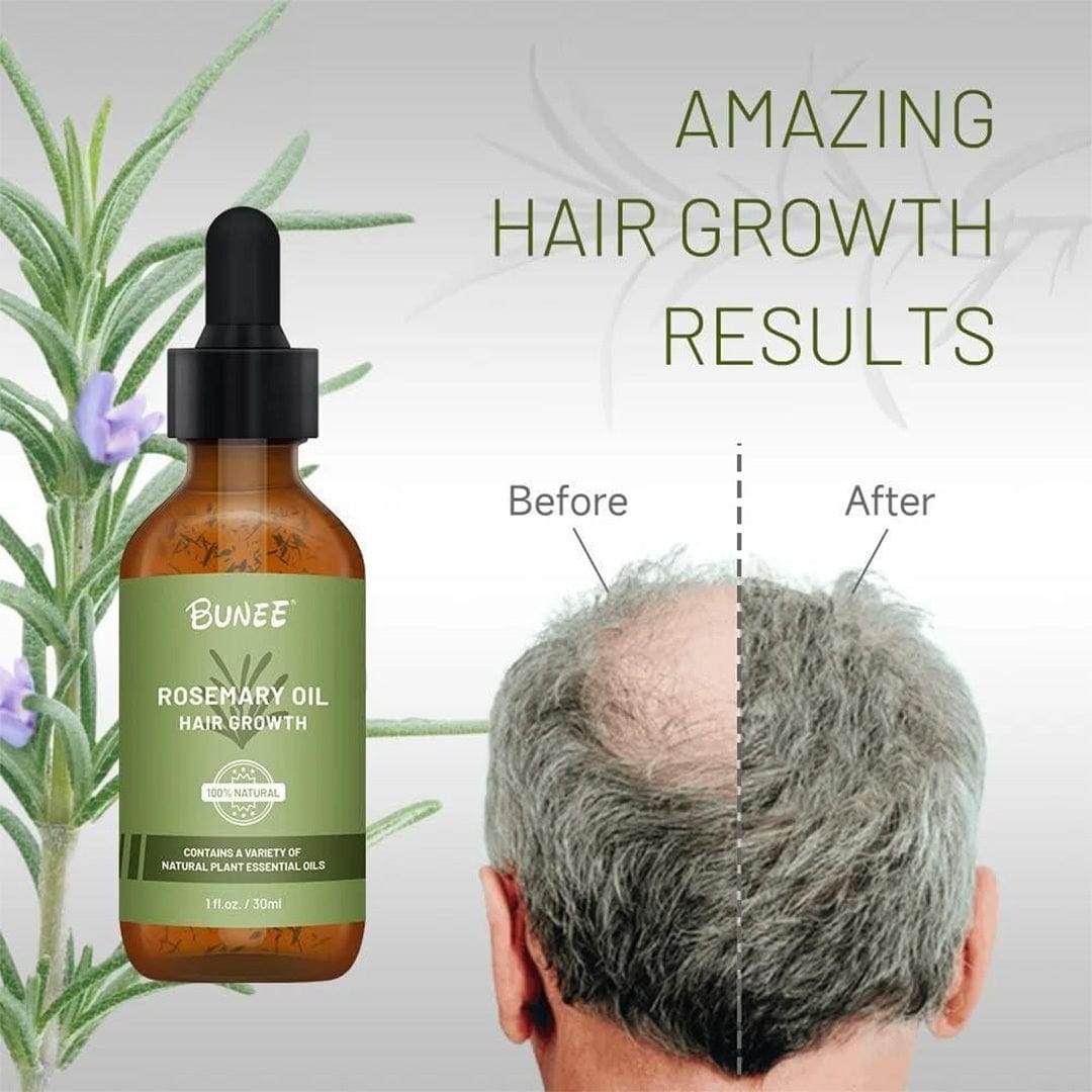 Rosemary Hair Growth Serum Oil Pack of 3 Rosemary Hair Growth Serum Oil