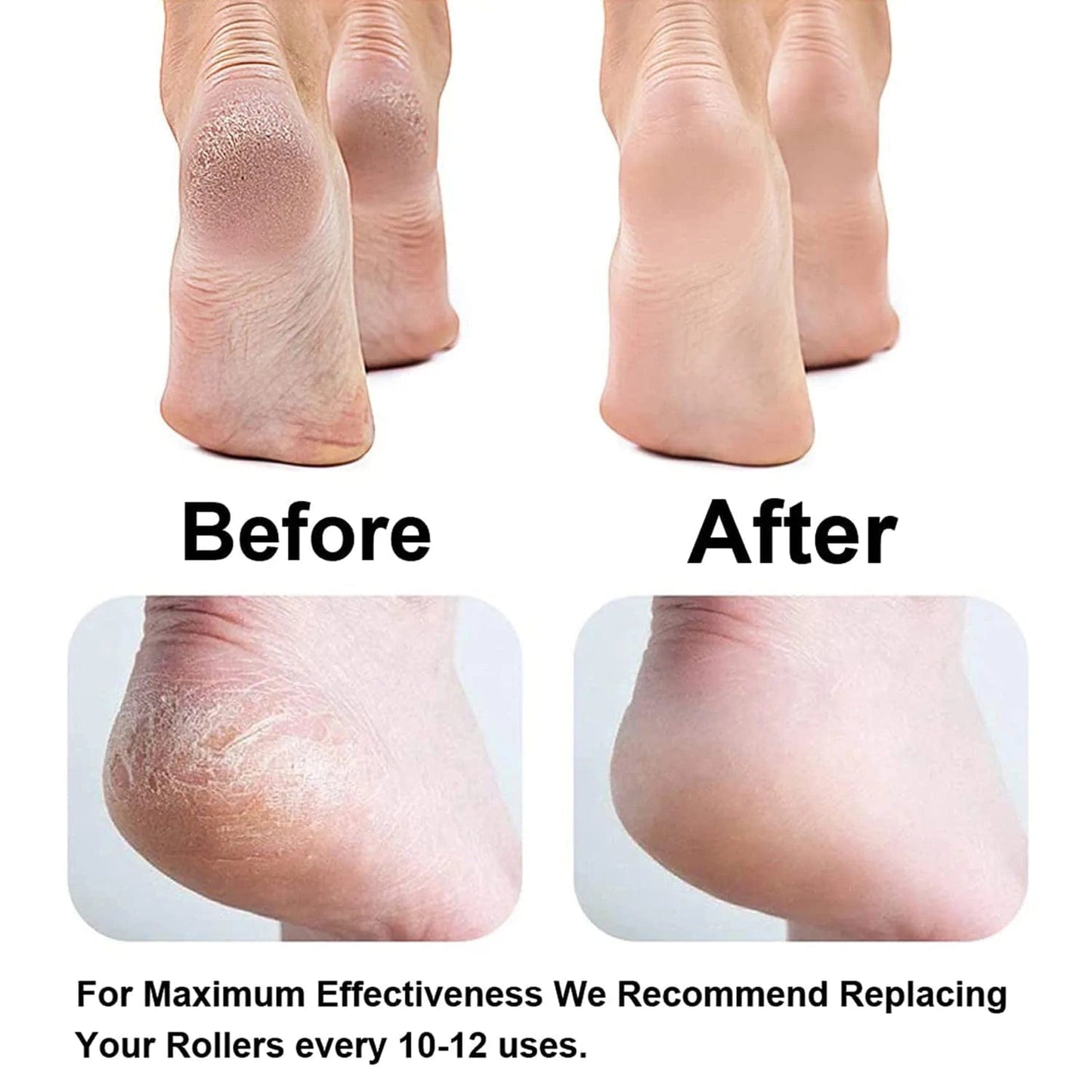 Scalli Pro™️ | Callus Remover Foot Treatment Cleaning Electric Callus Pads Scalli Pro™ Zaavio®