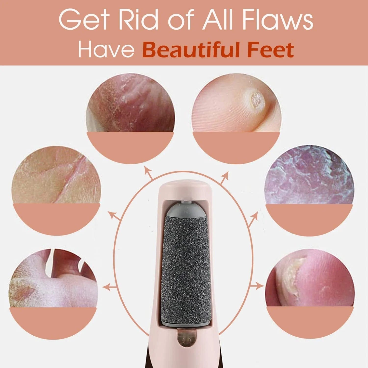 Scalli Pro™️ | Callus Remover Foot Treatment Cleaning Electric Callus Pads Scalli Pro™ Zaavio®