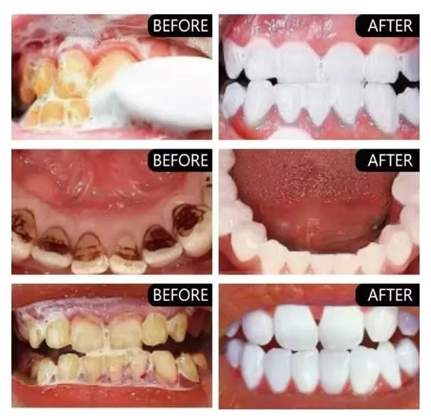 Smoke Stains White Plus Toothpaste (Set of 2) | Tooth Paste Decay Whitens Teeth Bad Breath Calculus Plaque Toothpaste Smoke Stains White Plus Toothpaste (Set of 2)