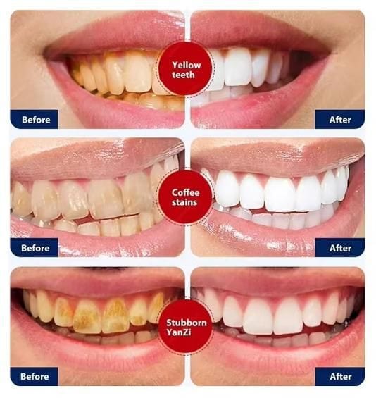 Smoke Stains White Plus Toothpaste (Set of 2) | Tooth Paste Decay Whitens Teeth Bad Breath Calculus Plaque Toothpaste Smoke Stains White Plus Toothpaste (Set of 2)