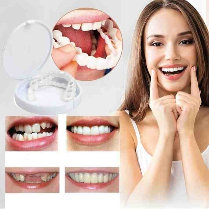 Snap-on Dentures | White Teeth Braces Clip On Veneer Teeth Perfect Dental Braces Snap-on Dentures