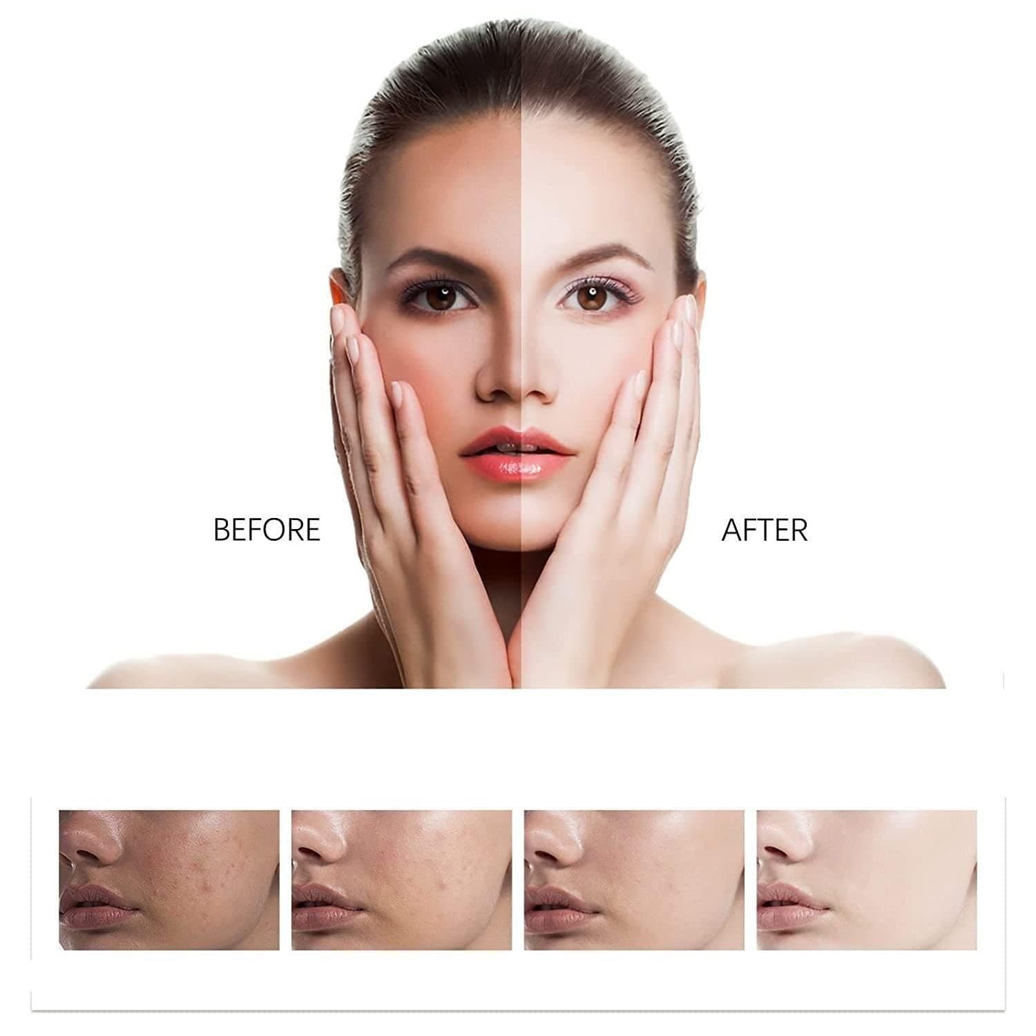Whitening Facial Cleanser | Facial Washing Cleanser For Face Dry Skin Cleanser Whitening Facial Cleanser