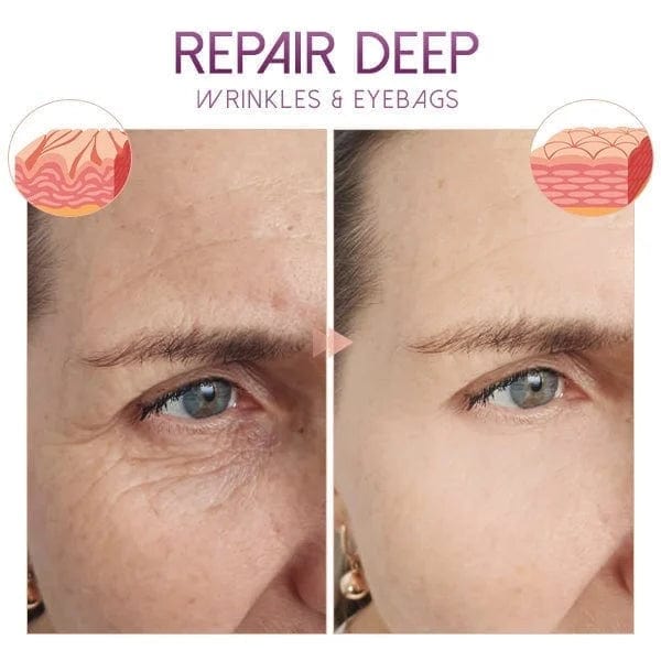 Anti ageing and Dark circle serum (Set of 2) Anti ageing and Dark circle serum (Set of 2)