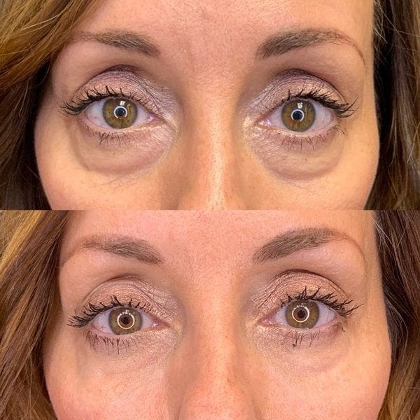 Anti Ageing Serum Dark Circles Anti Wrinkle Oil Under Eye Serum Under Eye Serum