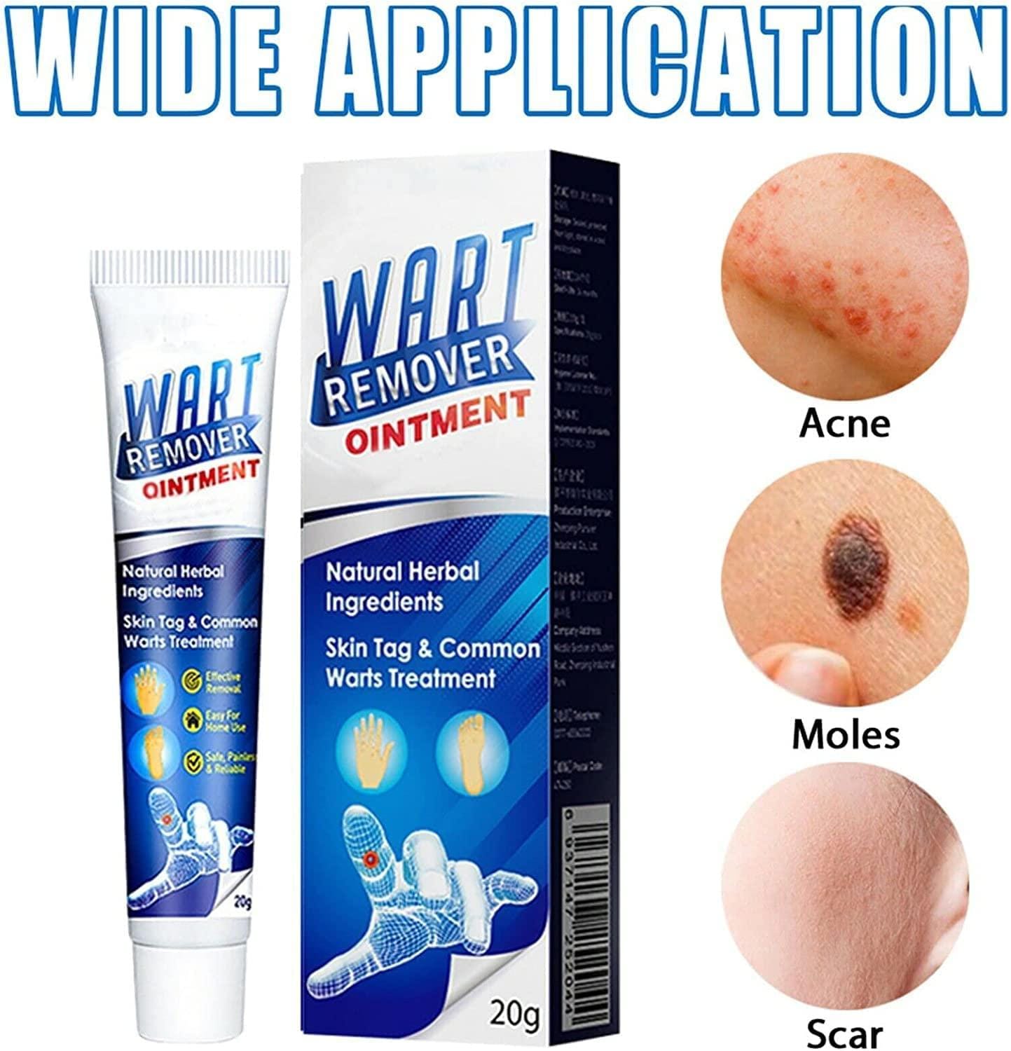 Wart Remover Ice Cream Mask Wart Remover Ice Cream Mask