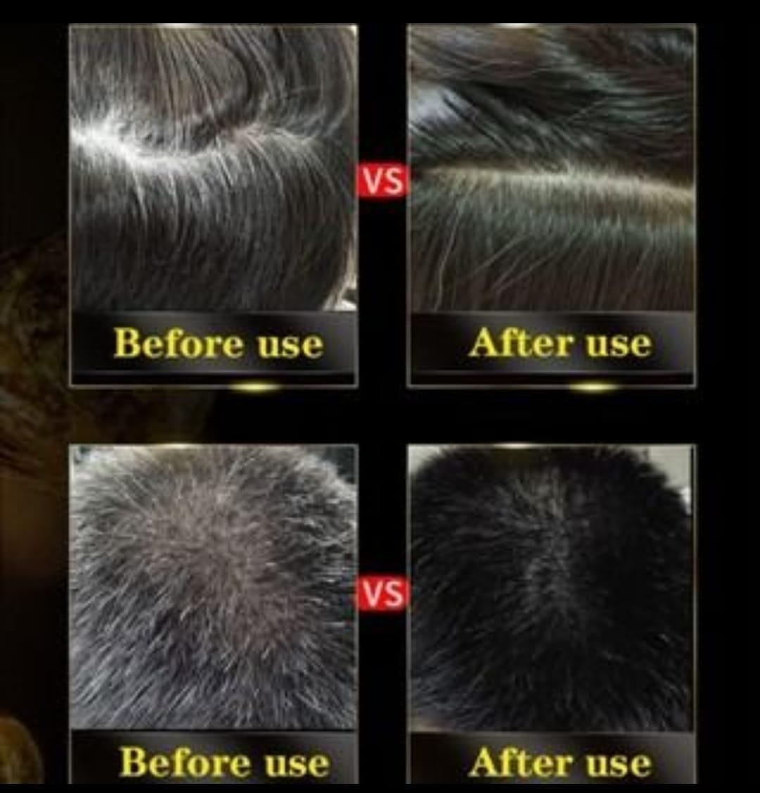 3 in 1 Black Hair Shampoo (Set of 2) 3 in 1 Black Hair Shampoo (Set of 2)