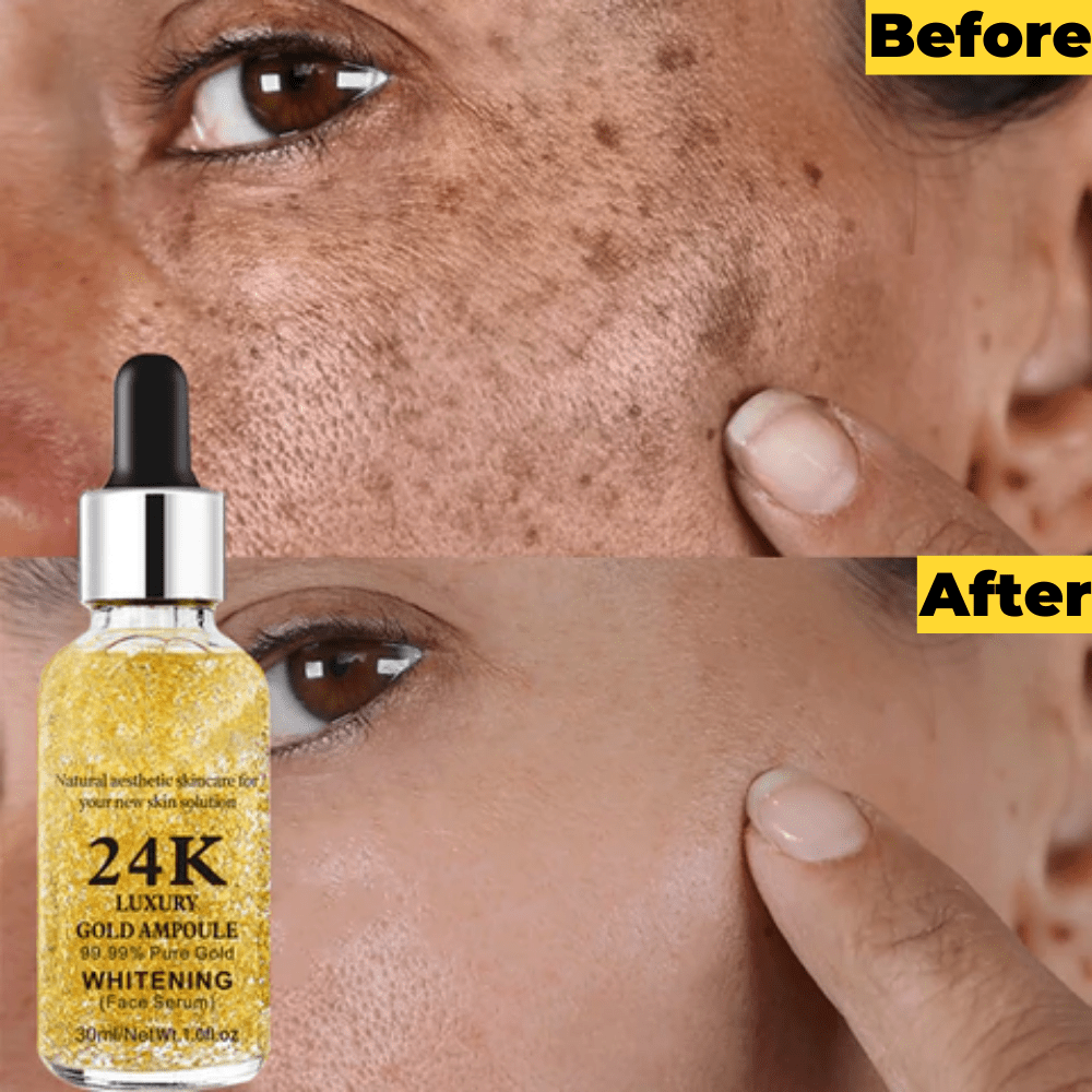 Anti Ageing Serum Dark Circles Anti Wrinkle Oil Under Eye Serum - Anti-aging Eye Serum (Set of 2) Anti-aging Eye Serum 24K Gold Serum (Set of 2)