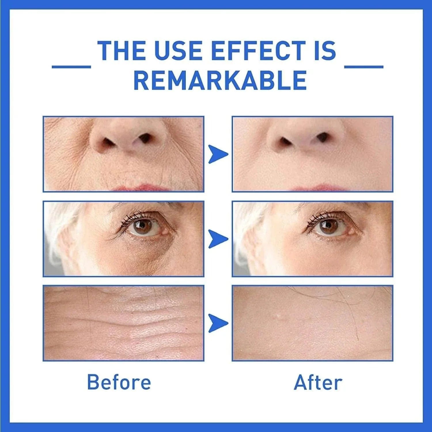 Antiage Face Serum (Set of 2) | Retinol Anti Ageing Serum Retinol For Skin Face Serum (Set of 2)