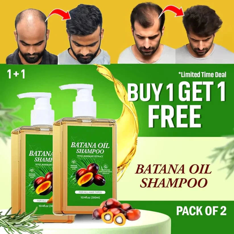 Batana Oil Shampoo for Hair Growth (Pack of 2) | Oil Rosemary Batana Oil Shampoo Hair Growth Conditioner Hair Care Batana Oil Shampoo for Hair Growth (Pack of 2) Zaavio.co®
