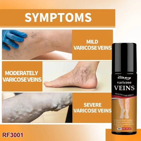 BEE VARICOSE VEINS RELIEF SPRAY (SET OF 2) Bee Venom Varicose Veins Relief Spray (Set Of 2)