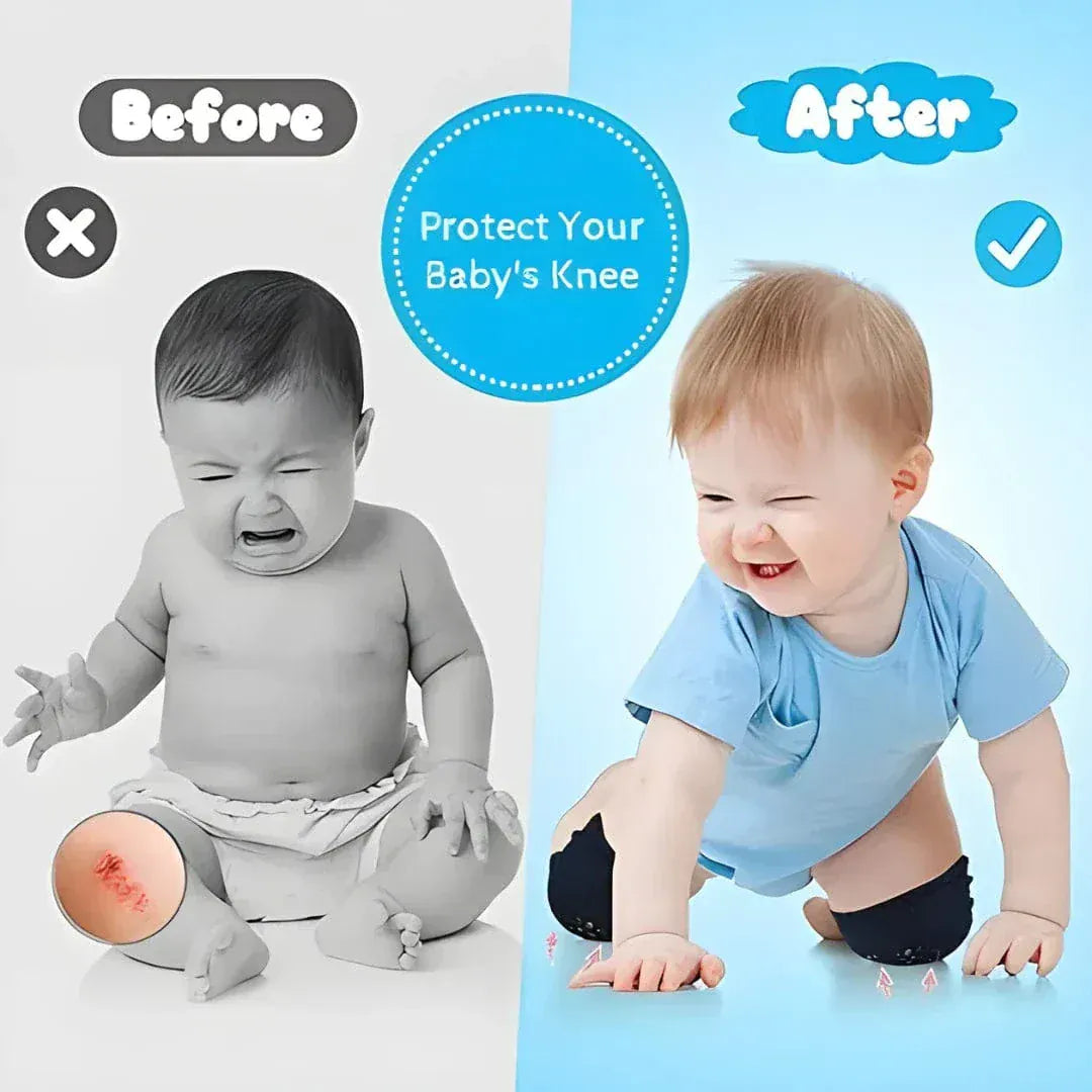 Crawloxi | Baby Products Care Infants Knee Pad Protector Crawling Anti Slip Crawloxi Baby Knee Pad For Safe Crawling (2 Pairs)