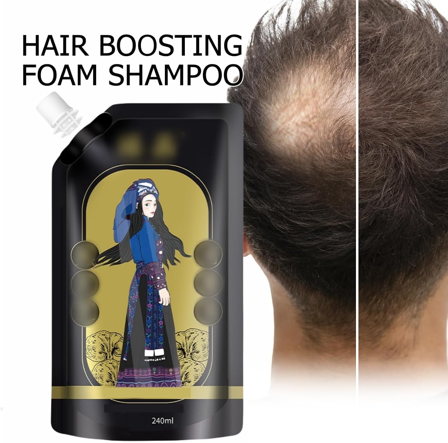Ginger Anti-hair Loss Shampoo | Anti Hair Fall Shampoo Hair Growth Ginger Hairex Reduce Hair Loss Ginger Anti-Hair Loss Shampoo (Set of 3)
