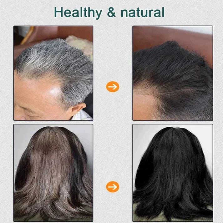 Hair Coloring Dye Shampoo Hair Color Natural Dye Herbal Coloring - Natural Plant Hair Dye (Pack of 2) Pack of 2 Natural Plant Hair Dye (BUY 1 GET 1 FREE)