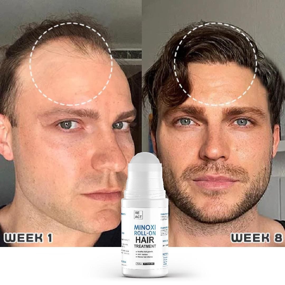 Hair Growth Serum Care Hair Solution Rolling for Regrow - Roll-on Hair Growth Treatment (Set of 2) Roll-on Hair Growth Treatment (Set of 2)