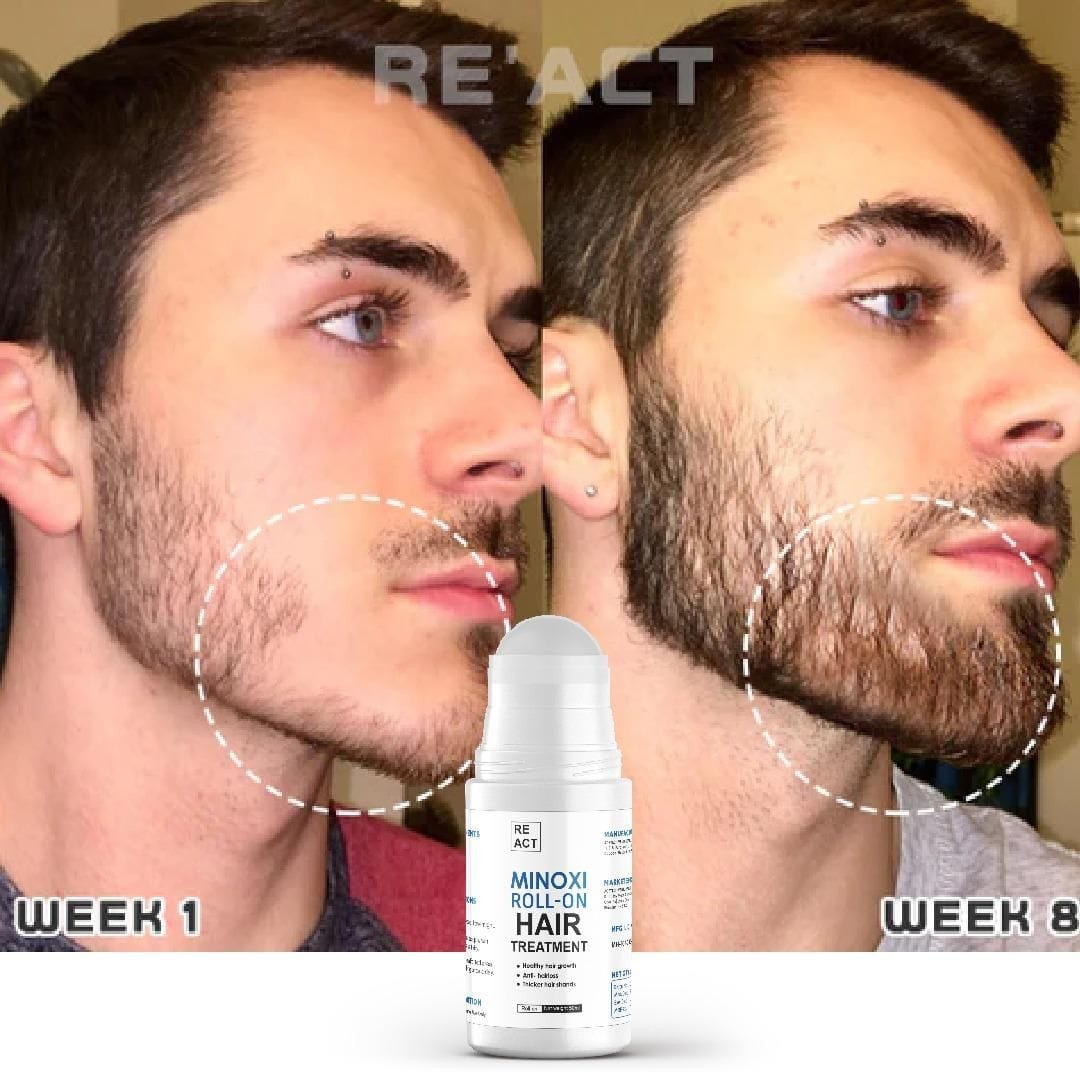 Hair Growth Serum Care Hair Solution Rolling for Regrow - Roll-on Hair Growth Treatment (Set of 2) Roll-on Hair Growth Treatment (Set of 2)