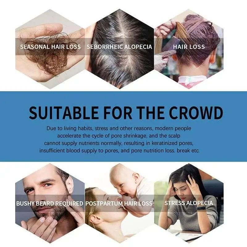 Hair Growth Serum Care Hair Solution Rolling for Regrow - Roll-on Hair Growth Treatment (Set of 2) Roll-on Hair Growth Treatment (Set of 2)