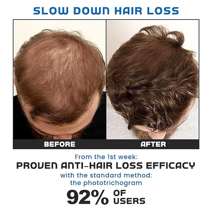 Hair Growth Serum Care Hair Solution Rolling for Regrow - Roll-on Hair Growth Treatment (Set of 2) Roll-on Hair Growth Treatment (Set of 2)