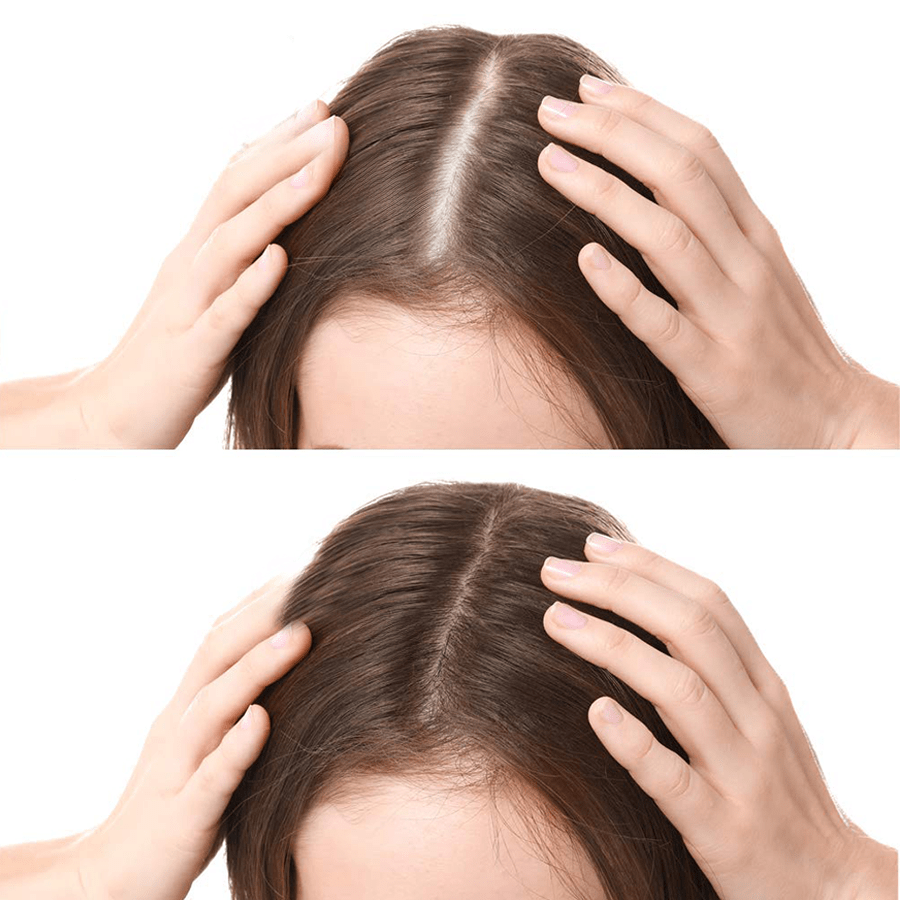 Hair Growth Spray Hair Growth Spray