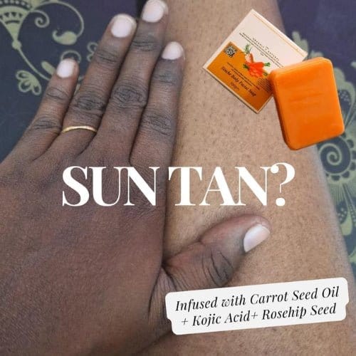Kojic Body Soap | Skin Whitening Soap Dark Spots On Skin Tone Kojic Soap Whitening Kojic Body Soap (Set of 3)