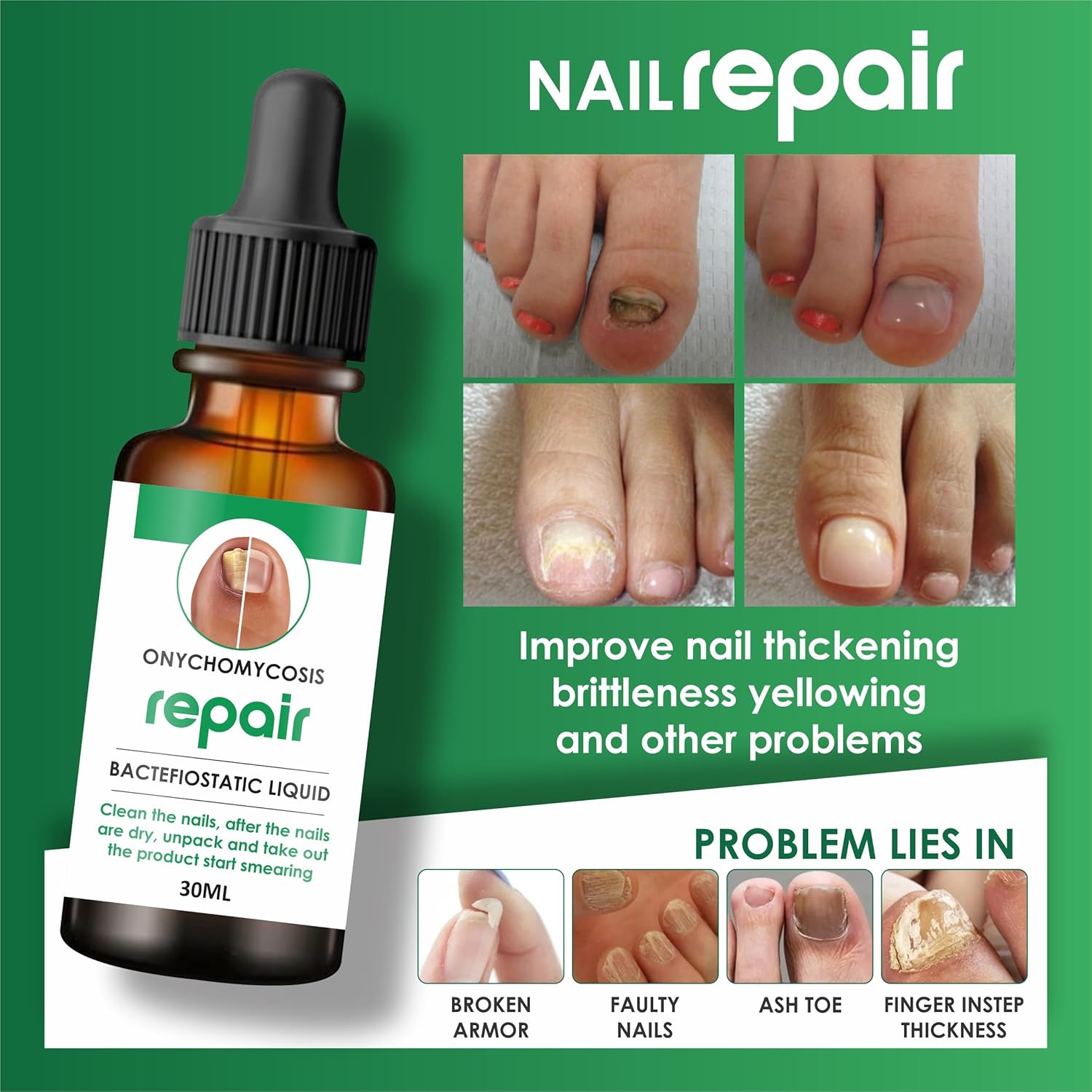 Nail Serum (Set of 2) | Brittle Nails Grow Nail Manicure Transparent Serum Nail Serum (Set of 2)