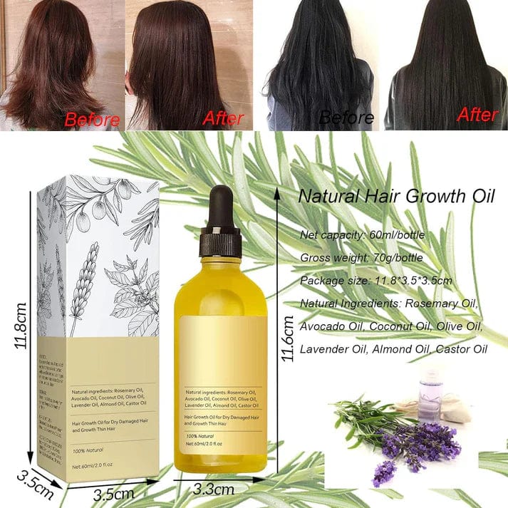 Natural Hair Growth Oil | Fall Control Hairline Growth Oil For Men And Women Natural Hair Growth Oil (Set of 2)