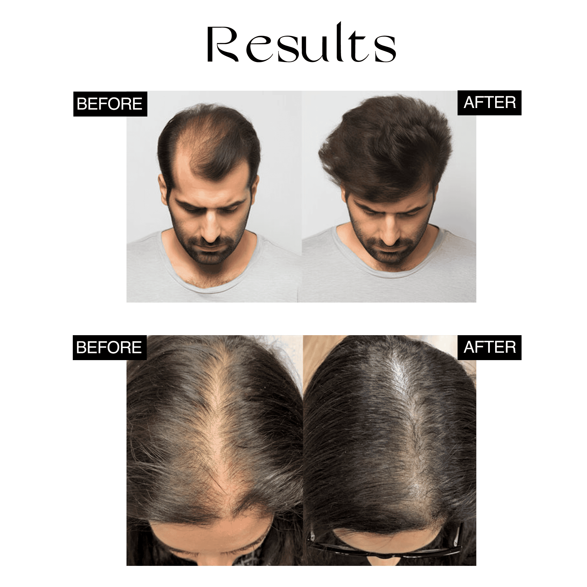 Organic Hair Serum Roller (Set of 2) BUY 1 GET 1 FREE Organic Hair Serum Roller (Set of 2)