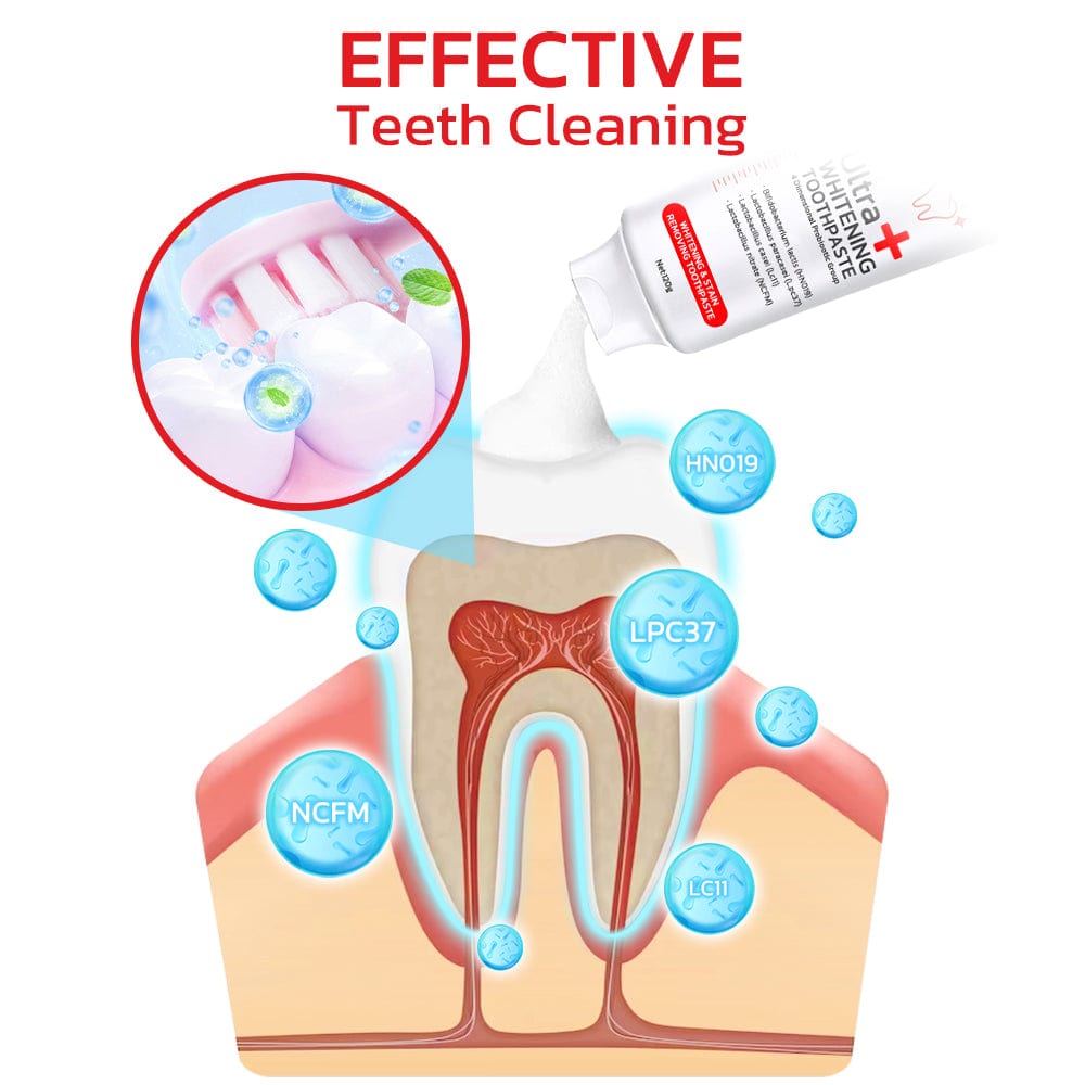 Probiotic Toothpaste | Teeth Whitening Tooth Paste Whitening Your Teeth At Home   Probiotic Toothpaste SP-4 (Set of 2)
