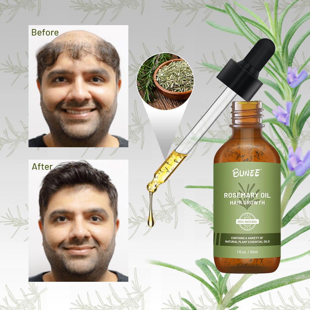 Rosemary Hair Growth Serum Oil Rosemary Hair Growth Serum Oil