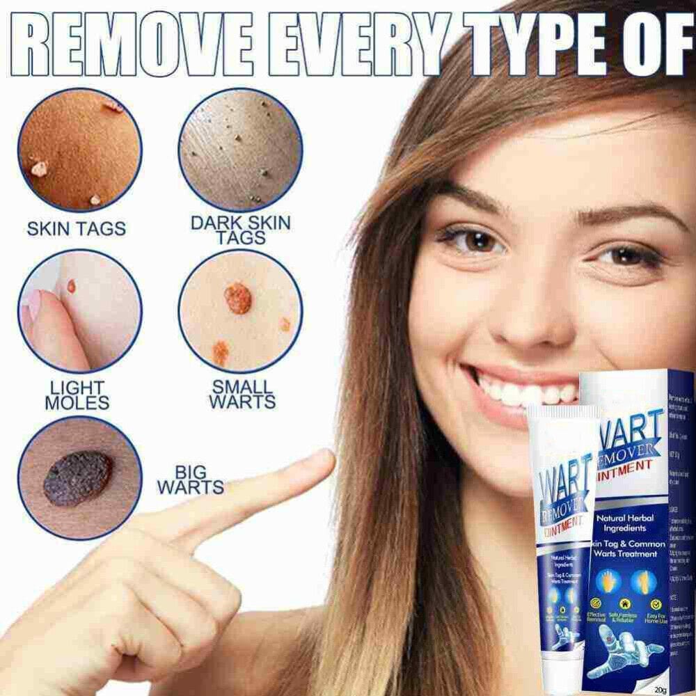 Salicylic Acid Wart Remover Black Head Removal Gel For Acne Wart Remover