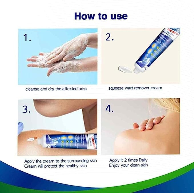 Salicylic Acid Wart Remover Black Head Removal Gel For Acne Wart Remover